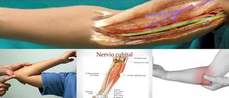 nervio cubital - nervio ciatico anatomia